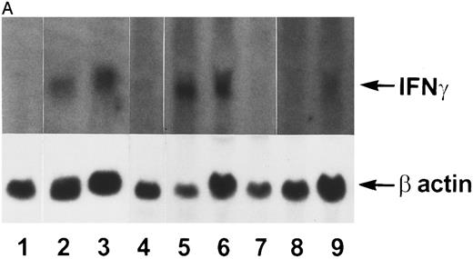 Fig. 2. Northern blot analysis. Tissue RNAs were extracted and analyzed for IFN-γ mRNA after electrophoresis through a formaldehyde-agarose gel as described in the Materials and Methods. (A) Lane 1, normal bone marrow; lane 2, transgenic bone marrow; lane 3, transgenic bone marrow; lane 4, normal thymus; lane 5, transgenic thymus; lane 6, transgenic thymus; lane 7, normal thymus; lane 8, normal spleen; lane 9, transgenic spleen. (B) Lane 1, normal thymic stromal cells; lane 2, transgenic thymic stromal cells; lane 3, normal thymocytes; lane 4, transgenic thymocytes.