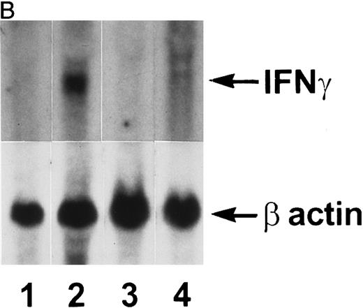Fig. 2. Northern blot analysis. Tissue RNAs were extracted and analyzed for IFN-γ mRNA after electrophoresis through a formaldehyde-agarose gel as described in the Materials and Methods. (A) Lane 1, normal bone marrow; lane 2, transgenic bone marrow; lane 3, transgenic bone marrow; lane 4, normal thymus; lane 5, transgenic thymus; lane 6, transgenic thymus; lane 7, normal thymus; lane 8, normal spleen; lane 9, transgenic spleen. (B) Lane 1, normal thymic stromal cells; lane 2, transgenic thymic stromal cells; lane 3, normal thymocytes; lane 4, transgenic thymocytes.