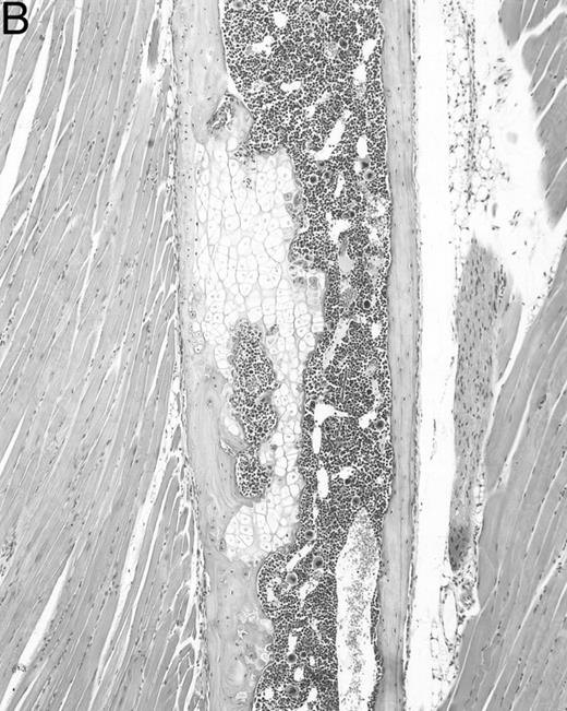 Fig. 4. Bone marrow alterations in IFN-γ transgenic mice. (A) Tibial bone marrow of a 3-month-old transgenic mouse showing granulomatous lesions (arrows) stained with H&E. The focal lesions were composed of clusters of histiocytes/macrophages (original magnification × 300; Bouin's fixed and paraffin-embedded section). (B) A rib of an 8-month-old transgenic mouse showing a cartilaginous mass in the marrow cavity attached to the cortical bone. Chondrocytes in the mass are degenerative. The mass is covered with a thin osseous layer. (Original magnification × 75; H&E; Bouin's fixed and paraffin-embedded section.)