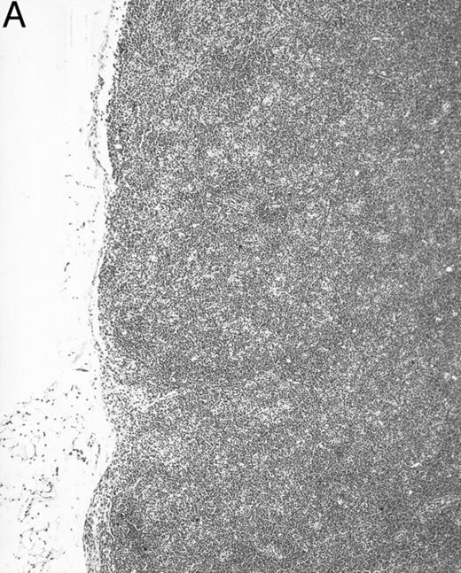 Fig. 7. B220 immunoreactivity in mesenteric lymph nodes of a 4-month-old transgenic mouse (A) and a control littermate (B). No follicle structures and no B220-immunoreactive cells are observed in the transgenic mouse. The control mouse has follicles with germinal centers (arrows) immunoreactive for B220. (Original magnification × 75; PGC-fixed and paraffin-embedded section; ABC immunohistochemistry; hematoxylin.)