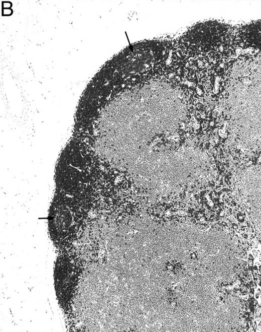 Fig. 7. B220 immunoreactivity in mesenteric lymph nodes of a 4-month-old transgenic mouse (A) and a control littermate (B). No follicle structures and no B220-immunoreactive cells are observed in the transgenic mouse. The control mouse has follicles with germinal centers (arrows) immunoreactive for B220. (Original magnification × 75; PGC-fixed and paraffin-embedded section; ABC immunohistochemistry; hematoxylin.)