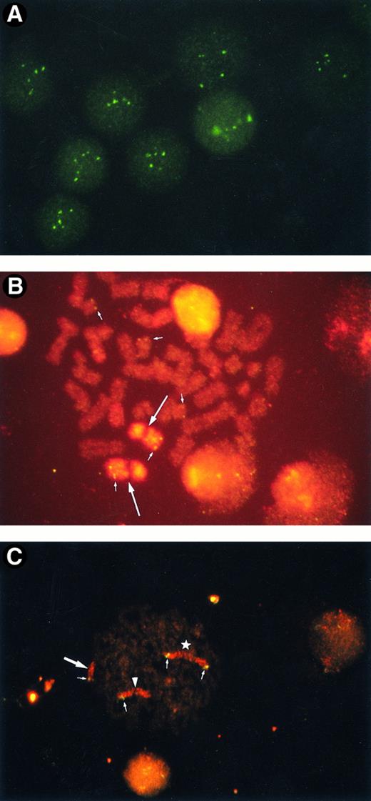 Fig. 1. (A) Amplified ABL oncogenes in patient no. 4, showing four to six signals in interphase cells. Some signals are slightly out of focus. (B) Amplified ABL oncogenes in patient no. 1, representing five copies in one metaphase (small arrows). Two homologues of chromosome 9 are stained with a spectrum orange WCP9 probe (large arrows). (C) Amplified chromosomal segment containing CD3-MLL genes from patient no. 4. Four chromosomal segments of 11q23 were found in one metaphase (small arrows): one was on the normal chromosome 11 (arrowhead), one on a derivative 12 (large arrow), and two on the isochromosome 11q10 (star). Chromosome 11 is painted in red with rhodamine and the CD3 gene in green with fluorescein.