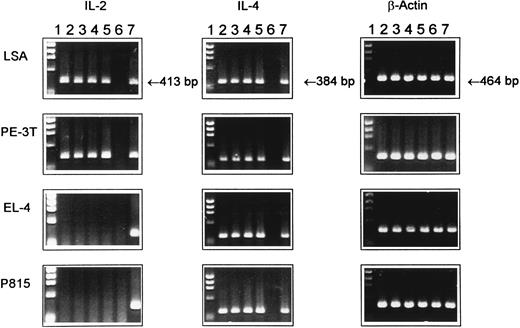 Fig. 3. Expression of IL-2 and IL-4 mRNA in tumor cell lines as detected by RT-PCR. Total RNA was extracted from various cell lines at 12, 24, 36, or 48 hours of ex vivo culture and was reverse-transcribed, and cDNA samples were subjected to PCR amplification using synthetic oligonucleotides primers for IL-2, IL-4, and β-actin as an internal control. The PCR product was electrophoresed through 1.5% agarose gel containing ethidium bromide. Lane 1, molecular size standard; lanes 2 through 5, cytokine gene expression at 12, 24, 36, and 48 hours of culture, respectively; lane 6, negative control consisting of normal unstimulated spleen cells from C57BL/6 mice; and lane 7, spleen cells cultured with ConA for 8 hours, used as a positive control.