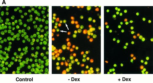 Fig. 4. Effect of calcium ionophore on the viability on FDC-P1 transfectants expressing or not expressing mcl-1. (A) Photographs of clone 7.5-MAMmcl-1 either left untreated (Control) or exposed to 1.5 μmol/L A23187 in the absence (−Dex) or presence of dexamethasone (+Dex), as assessed by the ethidium bromide/acridine orange method. Arrows indicate cells that have condensed nuclei but have not lost membrane integrity. Photographs were taken at a magnification of 400×. / (B) Clones 7.5-MAMmcl-1 and 8.5-MAMneo were either incubated (+) or not incubated (−) with dexamethasone for 2 hours at an inoculum density of 5 × 105 cells/mL. A23187 (1.5 μmol/L) was added and cell viability was was assayed at the indicated times using the ethidium bromide/acridine orange method. The values shown are the mean ± SD of three independent experiments.