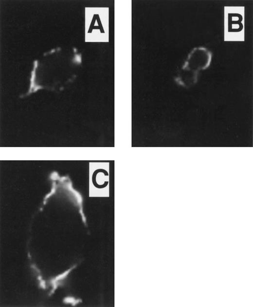Fig. 5. Immunofluorescent studies on COSdel.2-155 cells. Cells were preincubated on ice for 45 minutes with 24FM, washed, and exposed to 37°C for 0, 10, and 30 minutes (A, B, and C, respectively). After permeabilization and fixation, 24FM localization was identified as in Figs 3 and 4. Antibody-TM complex remained exclusively on the cell surface in these representative pictures (A, B, and C) over a 30-minute period. As with the COSdel.238 cells (Fig 4), there was no evidence of internalization or shedding of the complex.