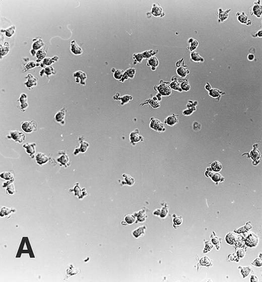 Fig. 1. Maturation of monocytes into macrophages. Monocytes were cultured in the protein-free medium Ultradoma-PF without (A) or with (B) 10% human serum. In the presence of serum, the cells acquire the typical morphologic features of cultured macrophages. Photographs were taken on day 6 of culture. Giemsa staining, original magnification × 50.