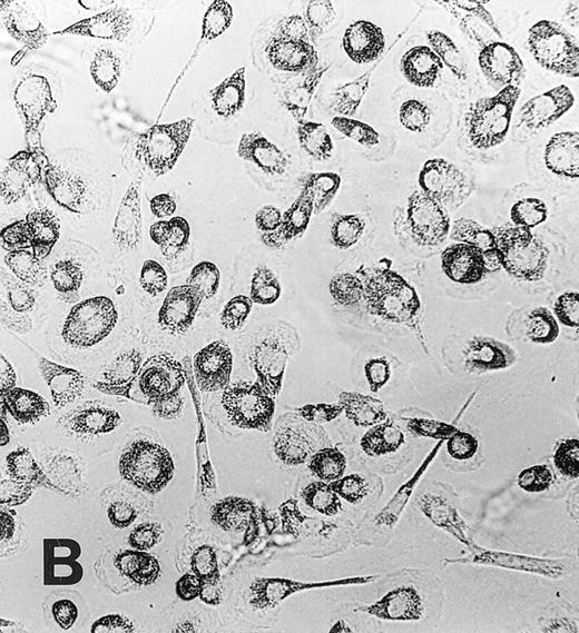 Fig. 1. Maturation of monocytes into macrophages. Monocytes were cultured in the protein-free medium Ultradoma-PF without (A) or with (B) 10% human serum. In the presence of serum, the cells acquire the typical morphologic features of cultured macrophages. Photographs were taken on day 6 of culture. Giemsa staining, original magnification × 50.