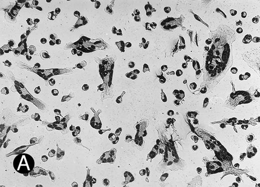 Fig. 3. (A) MGC derived from freshly isolated monocytes (day 0) stimulated with conditioned medium for 3 days. Giemsa, original magnification × 25. (B) Generation of MGC with PMA and HLA class II MoAb. Monocytes were cultured for 6 days in the presence of 10% human serum before stimulation. Giemsa, original magnification × 25.