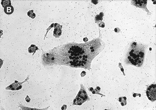 Fig. 4. Fig 4 (cont'd). (A) Influence of monocyte to macrophage maturation on the formation of MGC. Monocytes were cultured with (•) and without (▿) human serum to induce/prevent macrophage maturation and stimulated with conditioned medium. Six different media were compared (Ultradoma-PF, Ultradoma, RPMI 1640, SF3, CG, and RG, the latter two inducing monocyte maturation by themselves). Each point represents the mean of six experiments performed with cells obtained from different donors. Deviations from the mean are caused mainly by the donor variability found on day 0 (fusion rates ranging from 55% to 90%). The capacity to fuse is gradually lost during maturation. Asterisks indicate statistically significant differences between cultures with and without human serum (*P < .05, **P < .01). Two typical examples are shown in the photographs. Following culture in protein-free medium (Ultradoma-PF ) without (B) or in the presence of (C) human serum, formation of MGC is still possible (B) or markedly reduced (C). Stimulation was performed on day 5. Giemsa, original magnification × 50.