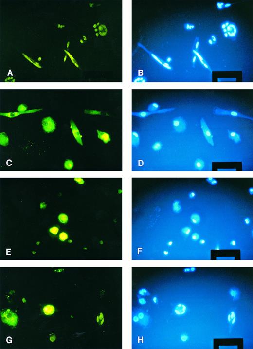 Fig. 5. Fusion between monocytes and macrophages. Macrophages were membrane labeled with the fluorescent dye PKH-2 (green). Monocyte membranes were not labeled, nuclei of both cell types were stained with the HOECHST dye (blue). (A) and (B) Freshly isolated monocytes stimulated for 3 days; several MGC have formed. (C) and (D) 1-week cultured macrophages stimulated with conditioned medium; no fusions have occurred. (E) and (F ) Freshly isolated monocytes added to 1-week cultured macrophages without stimulation; no spontaneous MGC formation. (G) and (H) Stimulation of monocytes and macrophages; two MGC can be seen, one derived from monocytes only, the other containing at least one macrophage. Original magnification × 100 (bar = 50 μm).