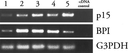 Fig. 2. Comparison of p15 and BPI mRNA levels in density-fractionated rabbit bone marrow cells. mRNAs from Percoll density gradient fractions of increasing density (1-5) were analyzed by RT-PCR as described in Materials and Methods. Absence of contamination (-cDNA control) was verified by subjecting a sample of the cDNA diluent (water) to PCR under each condition. Results shown are representative of two similar experiments.