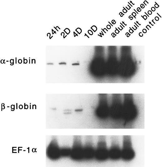 Fig. 10. RT-PCR analysis of expression of the adult α- and β-globin mRNA in zebrafish embryonic blood at 24 hours, 2 days, 4 days, and 10 days; in a whole adult zebrafish; in a zebrafish adult spleen; and in zebrafish adult blood. EF1-α is used as a control for RNA levels. A reaction with water (lane 4) is used as a negative control.