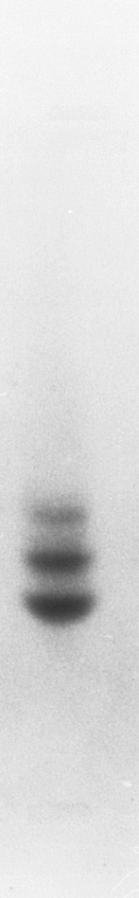Fig. 4. Hb electrophoresis of adult zebrafish blood. Two major and one minor band are detected.