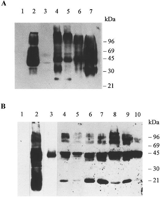 Fig. 2. Immunoblots of membrane proteins from erythrocytes and organs. Membranes were prepared as explained in Materials and Methods and the detergent soluble proteins were run in SDS-PAGE minigels, electrotransferred onto nitrocellulose membranes, and immunoblotted with antibody Fy6 at a dilution of 1/500 (A) and antibody 6615 at a dilution of 1/5000 (B). The antibodies were detected by chemiluminescence using the ECL Western blotting procedure as explained by the manufacturer (Amersham Life Science, Arlington Hts, IL). (A) Erythrocytes of a Duffy-negative individual (lane 1), erythrocytes of a Duffy-positive individual (lane 2), adrenal tumor of a Duffy-negative individual (lane 3), colon of a Duffy-negative individual (lane 4), colon of a Duffy-positive individual (lane 5), kidney of a Duffy-positive individual (lane 6), and spleen of a Duffy-positive individual (lane 7). Aliquots of 10 μg of erythrocyte membrane proteins and 60 μg of organ membrane proteins were analyzed per lane. (B) Erythrocytes of a Duffy-negative individual (lane 1), erythrocytes of a Duffy-positive individual (lanes 2 and 3), adrenal gland (lane 4), adrenal tumor of a Duffy-negative individual (lane 5), colon of a Duffy-negative individual (lane 6), colon of a Duffy-positive individual (lane 7), kidney of a Duffy-positive individual (lane 8), thyroid of a Duffy-positive individual (lane 9), spleen of a Duffy-positive individual (lane 10). For the negative control the spleen of a Duffy-positive individual was immunoblotted with preimmune serum and with a second antibody (not shown). A 25-μg aliquot of erythrocyte membrane proteins was analyzed in lanes 1 and 2 and a 2-μg aliquot of erythrocyte membrane proteins was analyzed in lane 3. A 60-μg aliquot was analyzed in each lane of membrane protein of tissues.