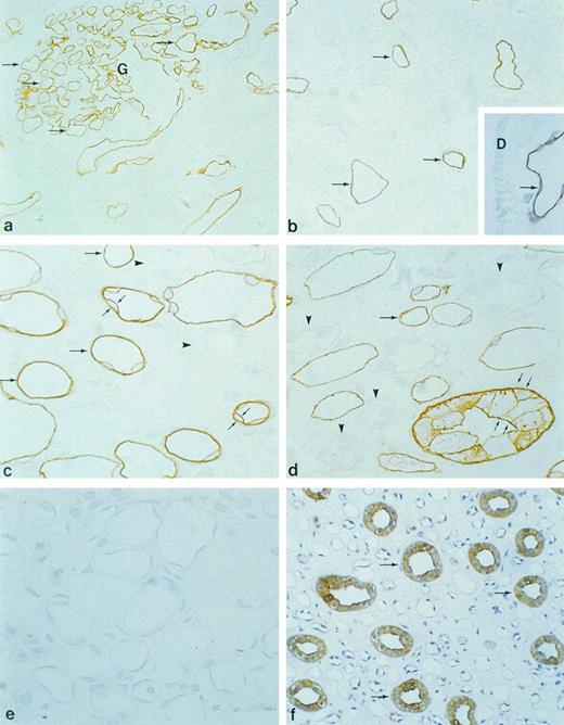 Fig. 3. Immunocytochemical localization of gp-Fy in semithin cryosections of human kidney cortex (a and b), outer medulla (c), and inner medulla (d and e). Antibody 6615 was used for labeling except in (f ). (a) Capillary endothelial cells within the glomerulus (arrows) and peritubular capillaries exhibited strong labeling. (Original magnification × 500.) (b) Cortical peritubular capillaries were labeled, while proximal and distal tubules were unlabeled. (Original magnification × 1,100.) (c) In outer medulla, strong labeling of vascular structures was seen (arrows), whereas multiple thin walled structures (descending thin limbs) were unlabeled (arrowheads). (d) In the inner medulla, strong labeling of vascular structures was seen (arrows), whereas multiple thin walled structures (descending and ascending thin limbs) were unlabeled (arrowheads). Collecting ducts exhibited strong labeling in the apical and basolateral plasma membrane domains (small arrows). (Original magnification × 1,100.) (e) When preimmune serum was used, no labeling was observed. (f ) Paraffin section of human kidney inner medulla labeled with anti-Fy6. There was faint labeling seen in some thin structures, presumably capillaries, whereas collecting ducts (arrows) exhibited strong labeling. (Original magnification × 240.) (Inset D) Paraffin section of human kidney labeled with immunopurified antibody 6615. The abundant labeling of capillary endothelium (arrow) confirmed the specificity of antibody 6615.