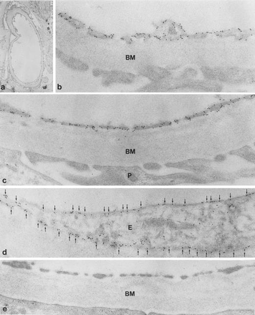 Fig. 4. Immunoelectron microscopic localization of gp-Fy in kidney glomerulus. Antibody 6615 was used for labeling. (a) Low magnification of the glomerular capillaries (original magnification × 6,000) and (b through e) higher magnification showed strong labeling (original magnification × 60,000). Endothelial cells (E) showed labeling of the apical and basal plasma membranes, including fenestration and caveolae. In contrast epithelial cells (podocytes, P) were unlabeled. (e) When preimmune serum was used, no labeling was observed. BM, basement membrane.