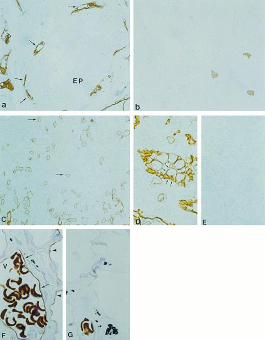 Fig. 7. Immunocytochemical localization of gp-Fy in semithin cryosections of human thyroid (a and b), spleen (C through E), and lung (F and G). Antibody 6615 was used for labeling. (a) Fenestrated capillary endothelial cells (arrows) exhibited strong labeling, whereas epithelial cells (EP) were unlabeled. (b) When preimmune serum was used, no labeling was observed. (C) The capillaries and postcapillary venules of spleen were labeled. (D) The cuboidal cells of HEV showed strong labeling of both apical and basal plasma membrane domains. (E) When preimmune serum was used, no labeling was observed. (F ) The endothelial cells of the large venule (arrows) with multiple erythrocytes (V) exhibited strong labeling. Arrowheads show labeling of the squamous alveolar cell (pneumocyte type 1). (G) When preimmune serum was used, no labeling was observed. (Original magnification × 1,100.)
