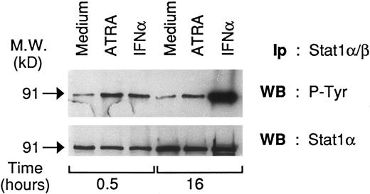Fig. 5. Effects of ATRA and IFNα on the tyrosine phosphorylation state of Stat 1α in NB4 cells. Cell lysates from NB4 cells unstimulated and stimulated with ATRA (10−6 mol/L) or IFNα (1,000 U/mL) for the indicated amount of time were immunoprecipitated with anti-Stat 1α/β antibodies. Two equivalent aliquots (30 μL) of the the various immmunoprecipitates (200 μL) were subjected to Western blot analysis in parallel and the corresponding filters were probed with antiphosphotyrosine (upper panel) and anti-Stat1α (lower panel) antibodies, respectively. The molecular weight of Stat1α is indicated on the left. Ip, immunoprecipitatory antibody; WB, Western blot antibody. A representative experiment out of three independent repeats is depicted.