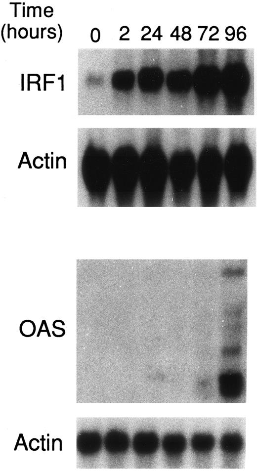 Fig. 7. Effects of ATRA on the levels of IRF1 and OAS mRNAs in NB4 cells. NB4 cells (4 × 105/mL) were treated for the indicated lengths of time with 10−6 mol/L ATRA. Total RNA was isolated and subjected (20 μg/lane) to Northern blot analysis. Filters were sequentially hybridized with cDNA probes coding for IRF1 and β-actin or OAS and β-actin. A Northern blot representative of two independent experiments is shown.