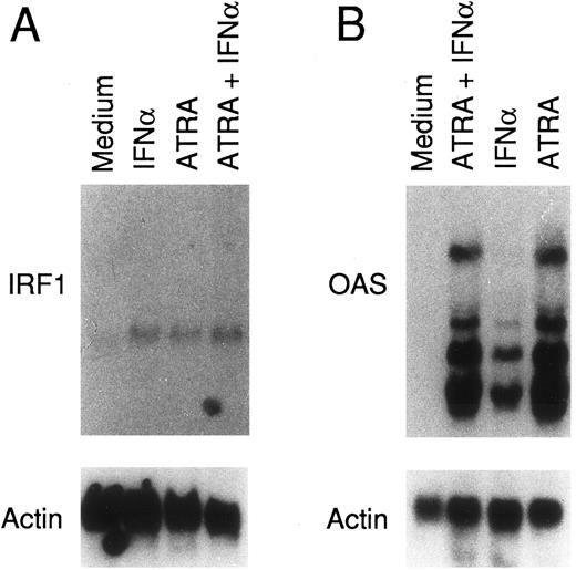 Fig. 8. Effects of ATRA, IFNα, and the combination of the two compounds on the levels of IRF1 and OAS mRNAs in NB4 cells. NB4 cells (4 × 105/mL) were treated for 4 days with medium alone (Medium) and medium containing ATRA (10−6 mol/L), IFNα (1,000 U/mL), or the combination of the two compounds. Total RNA was isolated and subjected (20 μg/lane) to Northern blot analysis. Filters were sequentially hybridized with cDNA probes coding for IRF1 and β-actin or OAS and β-actin. A Northern blot representative of three independent experiments is shown.