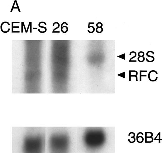 Fig. 2. Northern blot of patient samples probed with RFC and 36B4 as a loading control. (A) Patient sample (no. 26) with normal RFC expression and patient sample (no. 58) with no detectable RFC expression relative to CCRF-CEM (CEM-S) cell line. (B) Patient sample (no. 36) with decreased RFC expression relative to the CCRF-CEM (CEM-S) cell line.