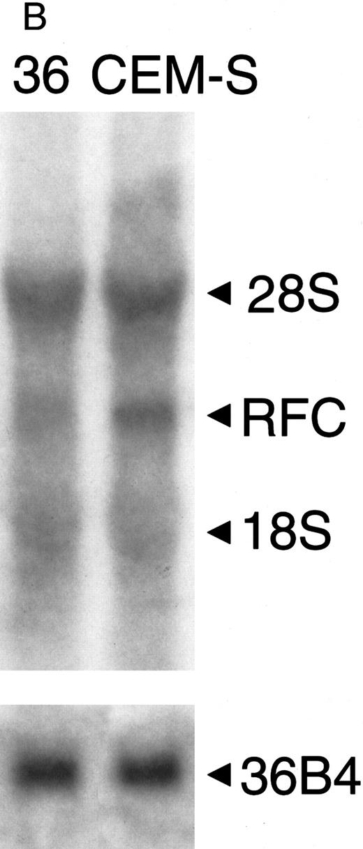 Fig. 2. Northern blot of patient samples probed with RFC and 36B4 as a loading control. (A) Patient sample (no. 26) with normal RFC expression and patient sample (no. 58) with no detectable RFC expression relative to CCRF-CEM (CEM-S) cell line. (B) Patient sample (no. 36) with decreased RFC expression relative to the CCRF-CEM (CEM-S) cell line.