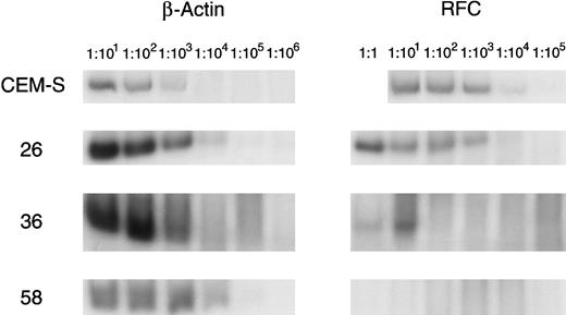 Fig. 3. Quantitative RT-PCR of patient samples for RFC expression. Serially diluted cDNA is amplified by PCR with primers for the RFC and β-actin, which is used as a standard. Patient samples with normal RFC expression (no. 26), no detectable RFC expression (no. 58), and decreased RFC expression (no. 36) are displayed with the CCRF-CEM (CEM-S) cell line.