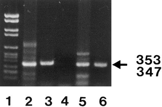 Fig. 2. PCR amplification of nucleotides 41 to 393 (lanes 3 and 6) and 309 to 655 (lanes 2 and 5) of neutrophil FcγRIIIB mRNA. The locations of the 2 primer pairs (arrows) used for PCR amplification of the expected 353- and 347-bp products after nested PCR are illustrated above. cDNA derived from a SH(−) (lanes 2 and 3) and a SH(+) individual (lanes 5 and 6) were amplified with primer pair no. 3 and no. 4 (lanes 3 and 6) or primer pair no. 5 and no. 6 (lanes 2 and 5) and analyzed on 1.5% agarose gel stained with ethidium bromide. PCR without template was run as negative control (lane 4). DNA size standards (pBr 328 DNA.BglI + pBr 328 DNA.HinfI) are shown in lane 1. The resulting 353-bp and 347-bp products from the SH(+) individual (lanes 5 and 6) were isolated from preparative gels and subcloned for nucleotide sequence analysis.
