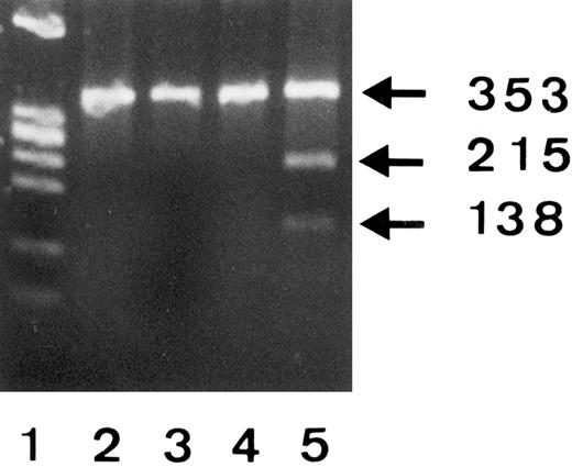 Fig. 4. RFLP analysis of 353-bp PCR products from 3 SH(−) (lanes 2, 3, and 4) and one SH(+) (lane 5) phenotyped individuals using SfaN I endonuclease and 2% Separide gel stained with ethidium bromide. DNA size standards (PhiX174 RF DNA.HaeIII) are shown in lane 1.