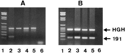 Fig. 5. PCR-SSP analysis of 1 SH(+) (lane 2) and 3 SH(−) phenotyped individuals (lanes 3 to 5) using SH(+)-specific primer no. 7 (A) and SH(−)-specific primer no. 8 (B). The 191-bp bands represent the allele-specific PCR products and the HGH bands the internal controls. PCR products were analyzed on 1.5% agarose gel stained with ethidium bromide. DNA size standards (pBr 328 DNA.BglI + pBr 328 DNA.HinfI) are shown in lane 1. Only in donor 1 was a SH(+)-specific PCR product (A, lane 2) formed.