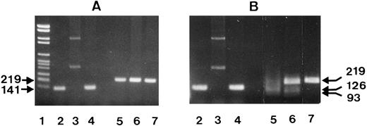 Fig. 6. Association of SH with NA2. (A) NA1(−) (lanes 2 to 4) and NA2(−) (lanes 5 to 7) specific PCR products before and, (B), after digestion with SfaN I. The locations of the NA-specific sense primers (NA1 pr., NA2 pr.) and the reverse primer (Reverse pr.) used for PCR amplification of the NA-specific DNA fragments, as well as the cleavage site of the SfaN I enzyme, are illustrated. Restriction fragments were analyzed on 1.5% agarose gel using DNA size standards pBr 328 DNA.BglI + pBr 328 DNA.HinfI (lane 1). Three individuals were tested who were typed as follows: SH(+), NA1(+),NA2(+) (lanes 2 and 5); SH(+), NA1(−),NA2(+) (lanes 3 and 6); SH(−), NA1(+),NA2 (+) (lanes 4 and 7).