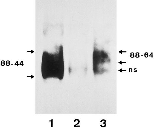 Fig. 7. Immunoprecipitation analysis of FcγRIIIb from a SH(+), NA1(+),NA2(+) individual using biotin-labeled granulocytes. After granulocytes were biotin-labeled and lysed, the FcγRIIIb was precipitated with a serum containing an isoantibody to FcγRIIIb (lane 1), a negative control serum (lane 2), and the SH-specific serum (lane 3). Immunoprecipitates were analyzed by 10% SDS-PAGE under nonreducing conditions, transferred onto nitrocellulose, and visualized using streptavidin-horseradish peroxidase and chemiluminescence substrate.