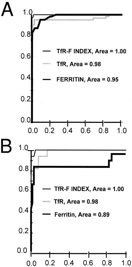 Fig. 3. ROC curves for TfR, ferritin, and TfR-F Index (TfR/log ferritin ratio) in the identification of iron-deficient patients. The ROC curves are shown separately for the whole patient population (n = 129) (A) and for the distinction between the ACD (n = 64) and COMBI (n = 17) patients (B). TfR-F Index -, TfR ▩, ferritin ▪.