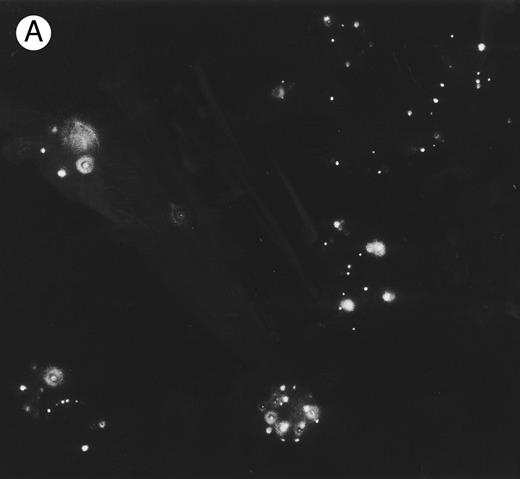 Fig. 5. Localization, by immunofluorescence, of CR1, band 3 antigen, and biotinylated sites on E surface. E were incubated with (A) MoAb 7G9 (anti-CR1) or (B) MoAb A9D3 (anti–band 3) followed by FITC–rabbit antimouse IgG and prepared for immunofluorescence. / (C) Biotinylated E were incubated consecutively with SA, biotinylated mouse IgG, and FITC–rabbit antimouse IgG. Parallel RIA (not shown) of E samples treated with 125I-labeled rabbit antimouse IgG (instead of the FITC conjugate) showed binding of approximately 10,000 rabbit IgG per E for all three samples.
