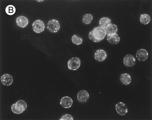 Fig. 5. Localization, by immunofluorescence, of CR1, band 3 antigen, and biotinylated sites on E surface. E were incubated with (A) MoAb 7G9 (anti-CR1) or (B) MoAb A9D3 (anti–band 3) followed by FITC–rabbit antimouse IgG and prepared for immunofluorescence. / (C) Biotinylated E were incubated consecutively with SA, biotinylated mouse IgG, and FITC–rabbit antimouse IgG. Parallel RIA (not shown) of E samples treated with 125I-labeled rabbit antimouse IgG (instead of the FITC conjugate) showed binding of approximately 10,000 rabbit IgG per E for all three samples.