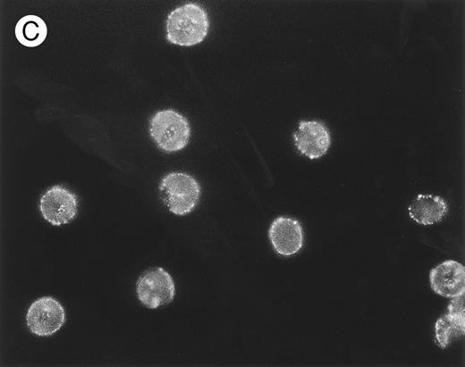 Fig. 5. Localization, by immunofluorescence, of CR1, band 3 antigen, and biotinylated sites on E surface. E were incubated with (A) MoAb 7G9 (anti-CR1) or (B) MoAb A9D3 (anti–band 3) followed by FITC–rabbit antimouse IgG and prepared for immunofluorescence. / (C) Biotinylated E were incubated consecutively with SA, biotinylated mouse IgG, and FITC–rabbit antimouse IgG. Parallel RIA (not shown) of E samples treated with 125I-labeled rabbit antimouse IgG (instead of the FITC conjugate) showed binding of approximately 10,000 rabbit IgG per E for all three samples.