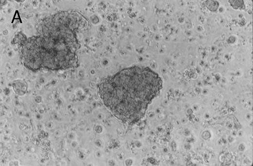 Fig. 1. Murine FNPB-derived colonies in methylcellulose cultures. (A) BFU-E colonies (day 8), (B) CFU-GM colony (day 8), (C) Late-developing colonies: very large colonies with poorly differentiated cells (day 28).