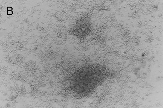 Fig. 1. Murine FNPB-derived colonies in methylcellulose cultures. (A) BFU-E colonies (day 8), (B) CFU-GM colony (day 8), (C) Late-developing colonies: very large colonies with poorly differentiated cells (day 28).