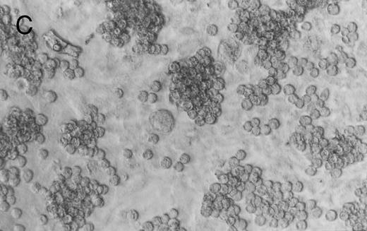 Fig. 1. Murine FNPB-derived colonies in methylcellulose cultures. (A) BFU-E colonies (day 8), (B) CFU-GM colony (day 8), (C) Late-developing colonies: very large colonies with poorly differentiated cells (day 28).