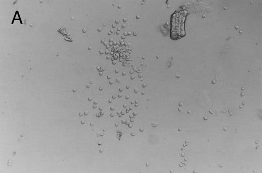 Fig. 3. Murine FNPB-derived colonies in methylcellulose cultures after ex vivo culture with hematopoietic growth factors (rMu SCF, rHu IL-3, rHu IL-6) in liquid culture media. (A) CFU-GM (day 3), (B) BFU-E (day 3), (C) Large colonies containing large blast-like cells (day 23).
