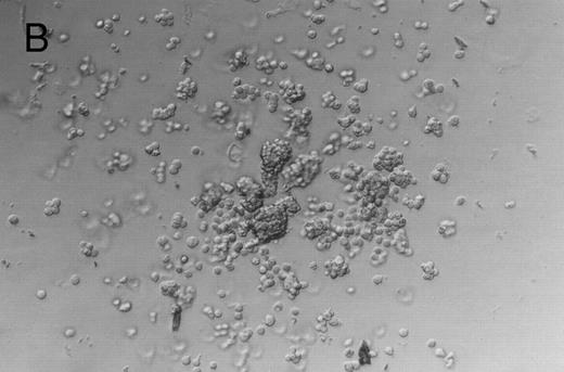 Fig. 3. Murine FNPB-derived colonies in methylcellulose cultures after ex vivo culture with hematopoietic growth factors (rMu SCF, rHu IL-3, rHu IL-6) in liquid culture media. (A) CFU-GM (day 3), (B) BFU-E (day 3), (C) Large colonies containing large blast-like cells (day 23).
