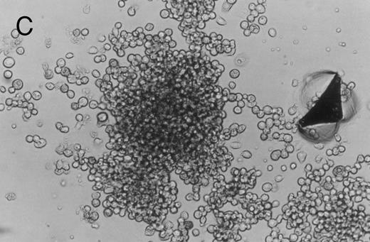 Fig. 3. Murine FNPB-derived colonies in methylcellulose cultures after ex vivo culture with hematopoietic growth factors (rMu SCF, rHu IL-3, rHu IL-6) in liquid culture media. (A) CFU-GM (day 3), (B) BFU-E (day 3), (C) Large colonies containing large blast-like cells (day 23).