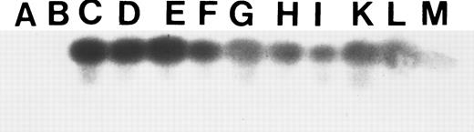 Fig. 5. Peripheral blood analysis of the eight transplant survivors. PCR amplification with MDR1 specific primers and Southern blot hybridization with a 32P-labeled human MDR1 cDNA probe were performed 2 to 4 months after transplantation. Lanes A and B represent negative controls: normal mouse spleen DNA. Lanes C and D represent positive controls: placental DNA MDR1 positive at 1:1,000 and 1:100 dilutions, respectively. Lanes E, F, H, I, and K represent the animals that received fresh-untreated donor cells. Lanes G, L, and M represent the animals that received ex vivo–cultured cells.
