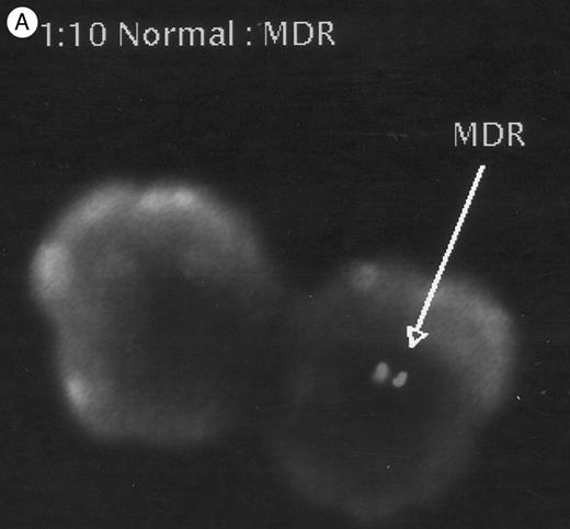 Fig. 6. FISH analysis of peripheral blood. (A) MDR positive control (1:10 dilution), (B) and (C) two animals tested 4 to 6 months after transplantation: cells displaying positive signals (arrows), as well as negative cells are shown.