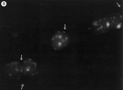 Fig. 6. FISH analysis of peripheral blood. (A) MDR positive control (1:10 dilution), (B) and (C) two animals tested 4 to 6 months after transplantation: cells displaying positive signals (arrows), as well as negative cells are shown.