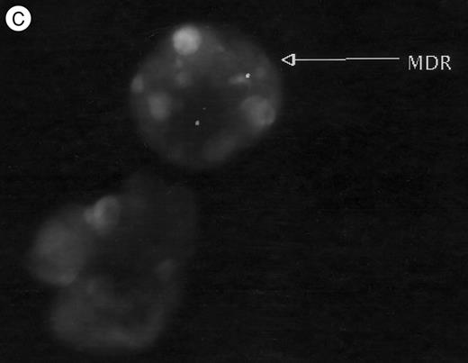Fig. 6. FISH analysis of peripheral blood. (A) MDR positive control (1:10 dilution), (B) and (C) two animals tested 4 to 6 months after transplantation: cells displaying positive signals (arrows), as well as negative cells are shown.