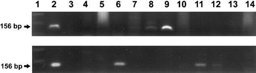 Fig. 7. Analysis of bone marrow-derived colonies from two recipient animals. PCR amplification of the transgene using MDR1 specific primers and agarose gel electrophoresis are shown. Upper panel: recipient of fresh-untreated cells, tested 8 months after transplantation. Lane 1 represents the molecular size marker. Lane 2 represents the positive control (156-bp fragment). Lane 3 shows the negative control. Lanes 4 to 14 represent the BM-derived colonies. Three positive colonies were detected, as seen in lanes 7, 8, and 9. Lower panel: Recipient of ex vivo cultured cells, tested 14 months after transplant. Lane 1 represents the molecular size marker. Lane 2 represents the positive control. Lanes 3 to 13 represent the BM-derived colonies (pooled). Three positive samples were detected, as seen in Lanes 6, 11, and 12. Lane 14 shows the negative control (pooled colonies from normal, MDR-negative mouse).