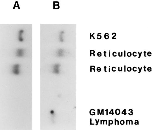 Fig. 2. Expression of HKR gene. The Northern blot analysis was done for total RNA (∼20 μg each) from reticulocyte, K562 cells, and lymphocytic cell line. (A) Hybridization with HKR -specific probe; (B) Hybridization with HKI -specific probe.