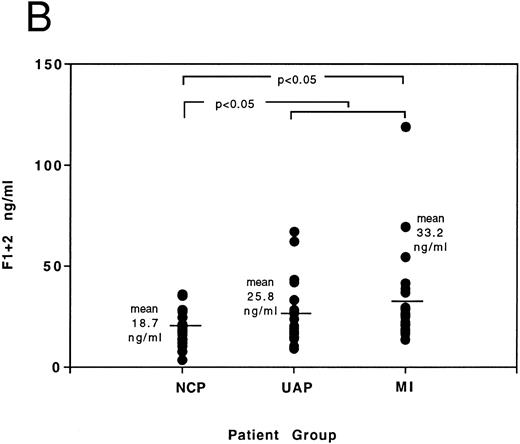 Fig. 5. (A) Individual distribution of FVIIa results determined by ELISA in patients presenting with noncardiac chest pain (NCP), unstable angina (UAP), and myocardial infarction (MI). The significance of differences between results of noncardiac chest pain group and (A) unstable angina group, and (B) all patients with acute coronary syndromes, is indicated by the P value. (B) Individual distribution of F1 + 2 results determined by ELISA in patients presenting with noncardiac chest pain (NCP), unstable angina (UAP), and myocardial infarction (MI). The significance of differences between results of noncardiac chest pain group and (A) myocardial infarction group, and (B) all patients with acute coronary syndromes, is indicated by the P value.