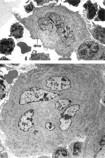 Fig. 6. Transmission electron micrographs of BM megakaryocytes from a mouse injected with 1% NMS (a) and a mouse injected with 250 μg/kg rmMGDF (b). Although considerably larger in size than cells from control animals, the megakaryocytes from MGDF-treated animals contain normally distributed organelles within their cytoplasm, including the demarcation membrane system. Nu, nucleus; dms, demarcation membrane system. Original magnification × 4,000.